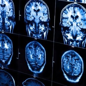 Study links kynurenine pathway to adolescent depression